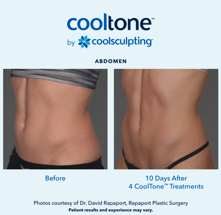 CoolTone Results