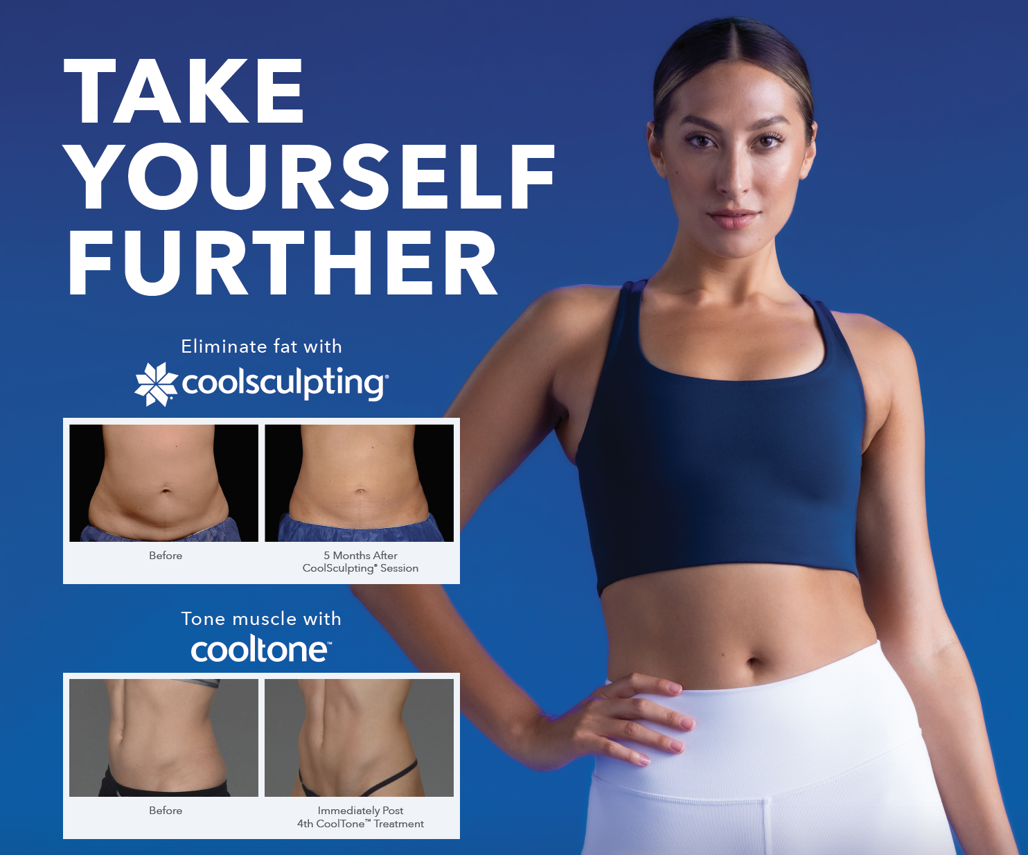 Back / Bra Fat - Elite Body Contouring in Northern Virginia