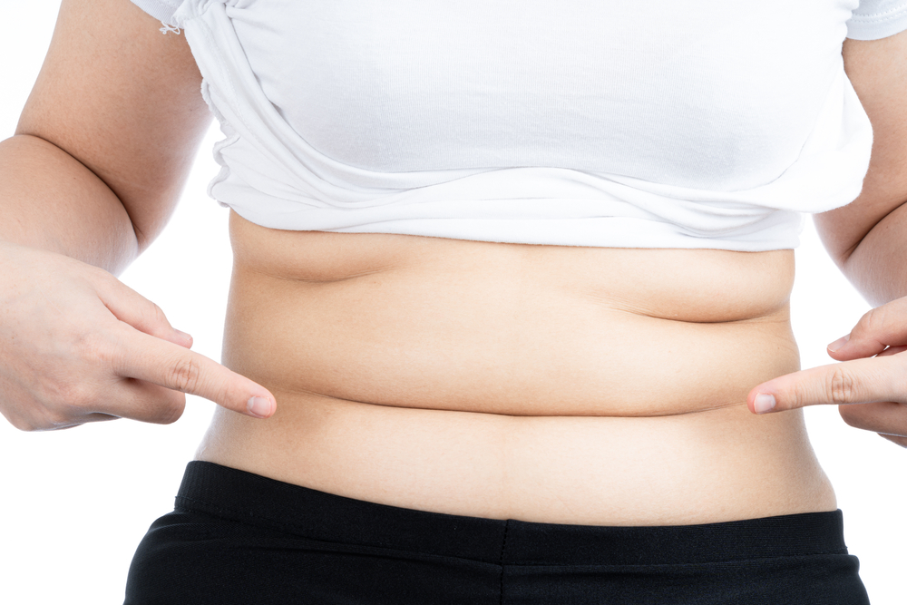 How Much Fat Should I Expect to Lose From CoolSculpting?