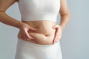 Best Coolsculpting Cost for Belly Fat in Washington, DC