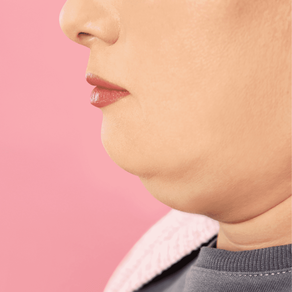 How Much Does the Best CoolSculpting for Double Chin Cost in Virginia