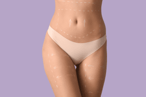 Top Rated CoolSculpting Clinics in Arlington Offering Free Appointments