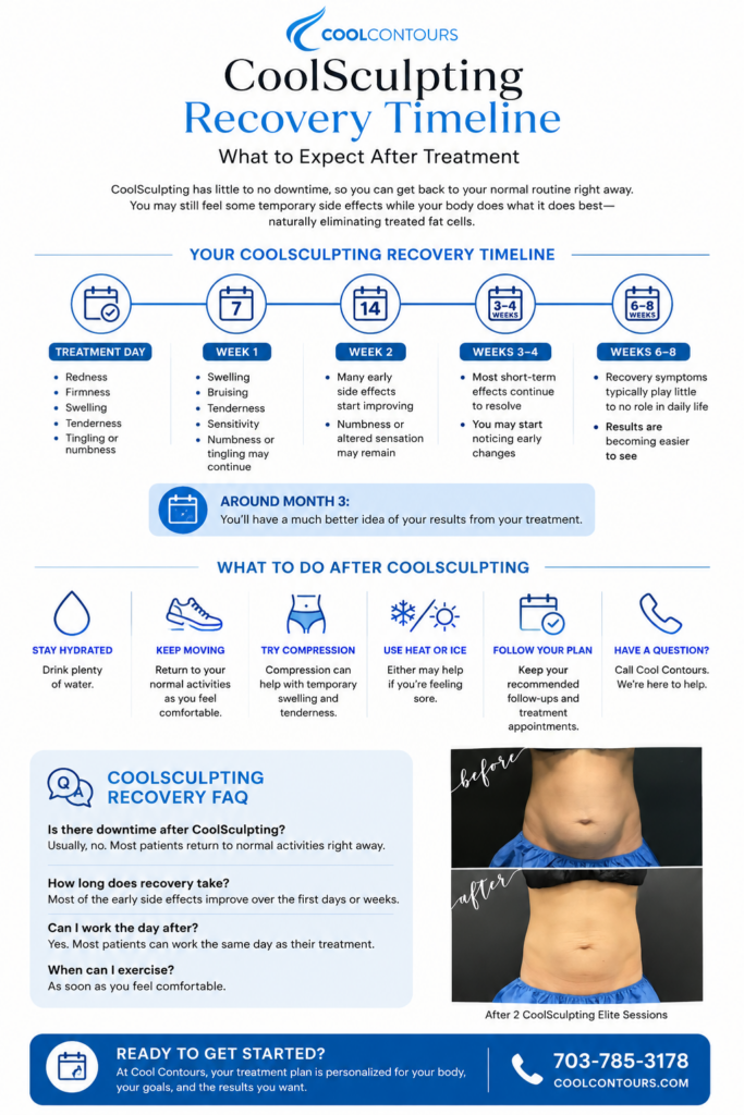 CoolSculpting recovery timeline showing common side effects from treatment day through weeks 6 to 8, post-treatment care tips, and a real Cool Contours before-and-after result.