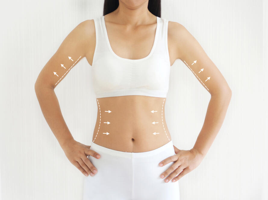 What to Expect From CoolSculpting in Northern Virginia: Treatment Timelines
