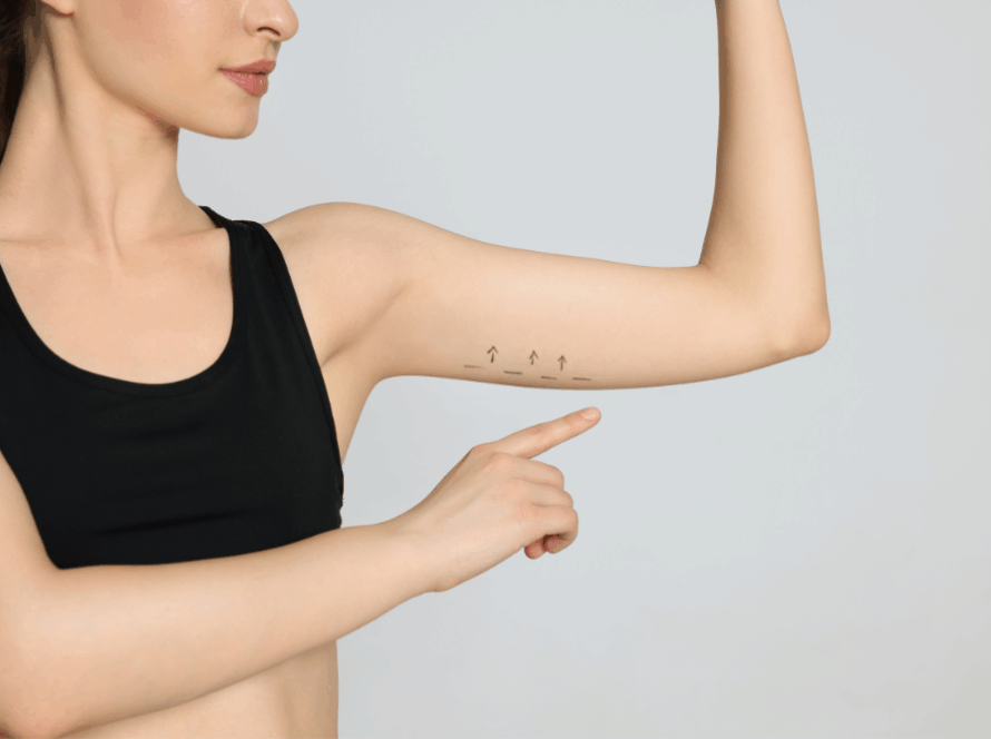 Non-Surgical Liposuction vs. Traditional Liposuction