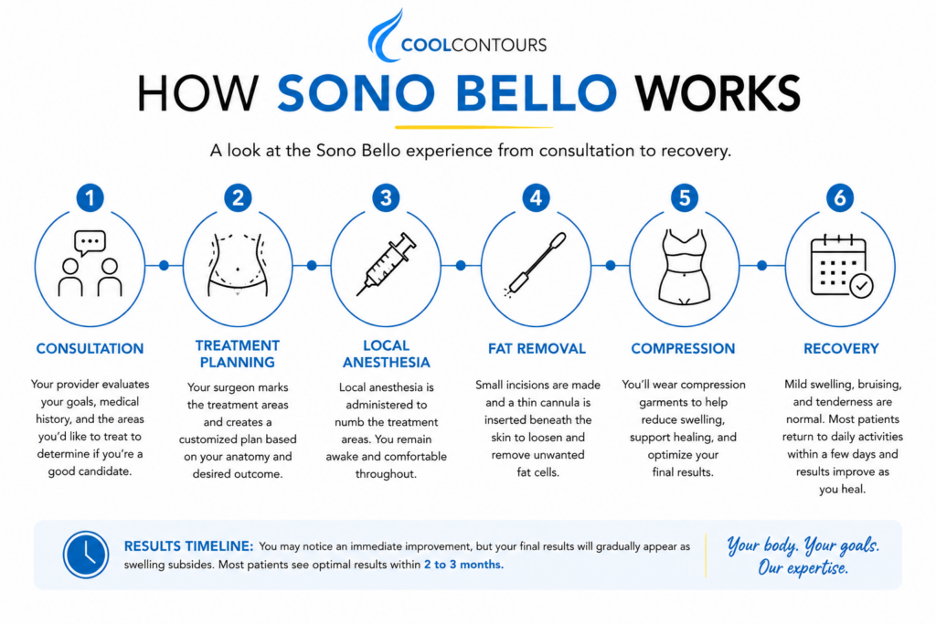 Timeline infographic comparing the patient journey at Sono Bello versus CoolContours. The graphic follows a clean blue and white design with gold accent icons. The top timeline illustrates the Sono Bello process, beginning with liposuction surgery, followed by bruising and swelling, several weeks of recovery, gradual improvement over several months, and final results. The bottom timeline shows the CoolContours process, beginning with a consultation, followed by a series of non surgical CoolSculpting treatments, no downtime, gradual fat reduction over several months, and final body contouring results. The graphic emphasizes the contrast between surgical recovery and a non surgical treatment experience while maintaining CoolContours branding.