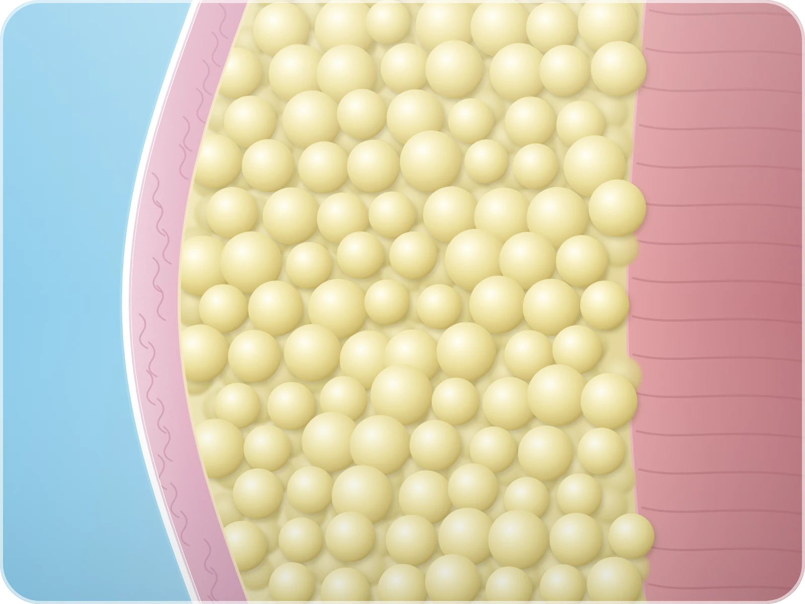 Illustration of stubborn fat cells under the skin