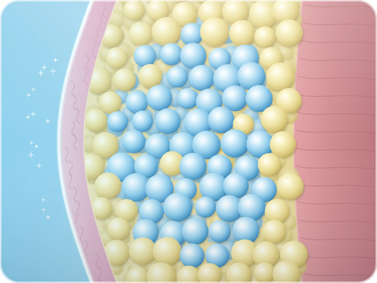 Illustration of controlled cooling targeting fat cells, shown in blue, while the skin stays protected